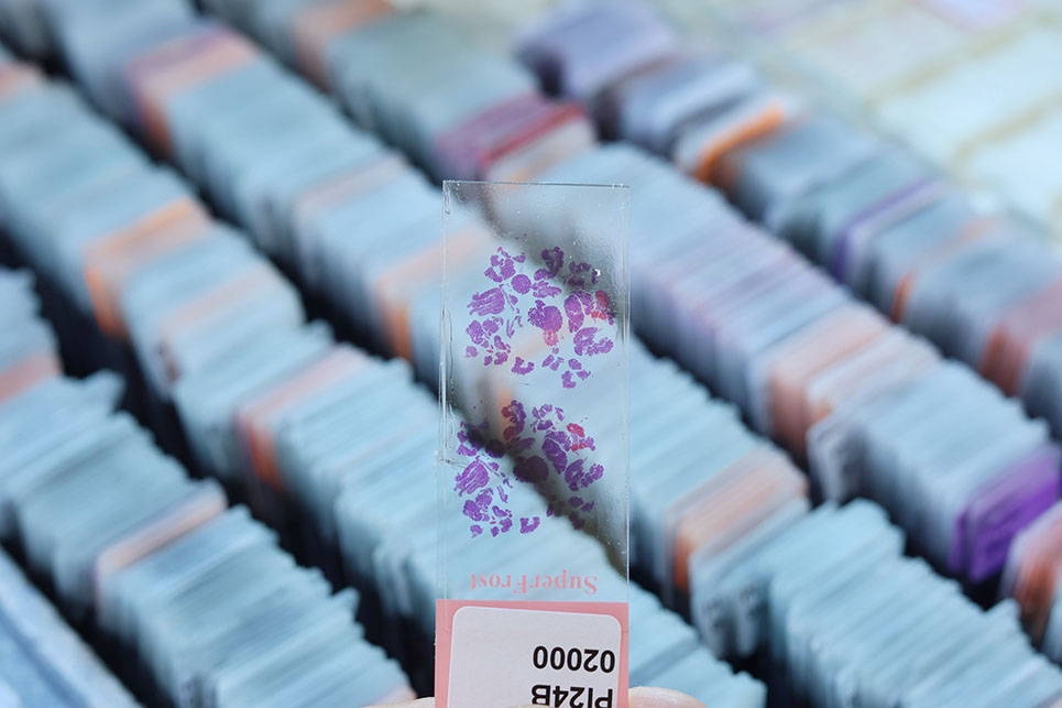 Patologia Integrada - Anàlisis mostres biològiques