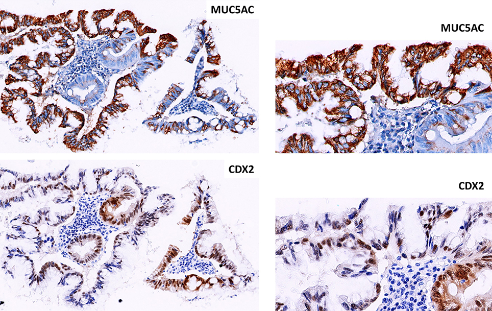Patologia Integrada - Immunohistoquímica